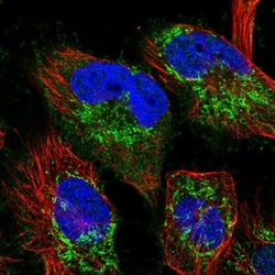 TTC19 Antibody, Novus Biologicals:Antibodies:Primary Antibodies